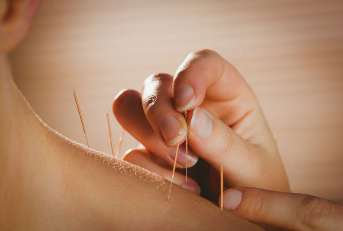 10 Ways Acupuncture Can Boost Your Wellness